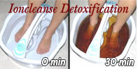 Ioncleanse Detoxification